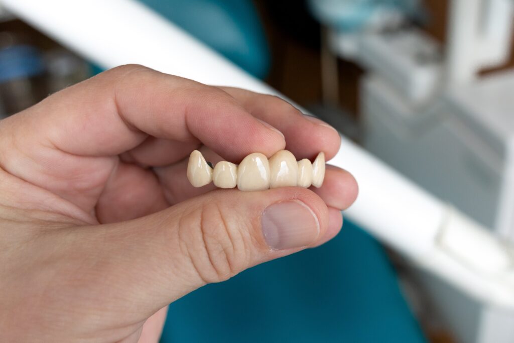 Types of Dental Implants - Marylebone Implant Centre